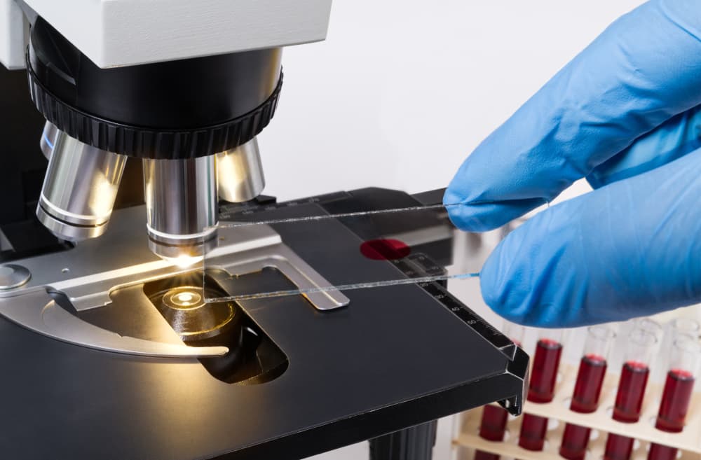 Veterinarian testing dog's blood.