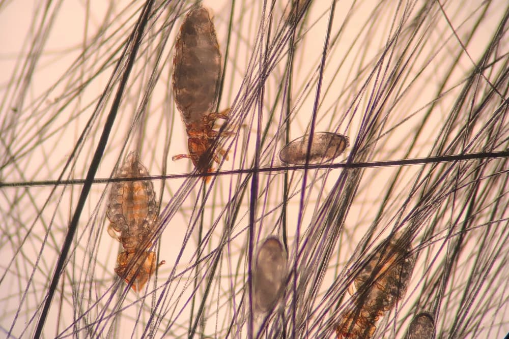 cat lice in fur