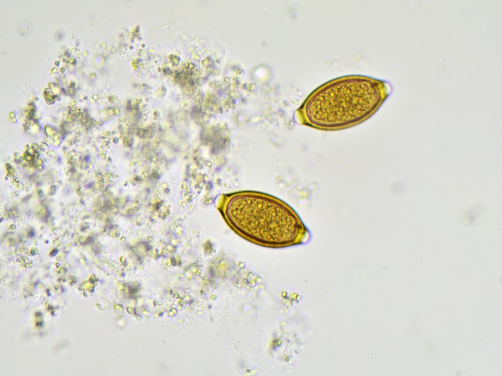 Whipworm eggs under a microscope