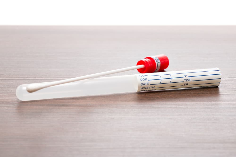 dog DNA testing swab