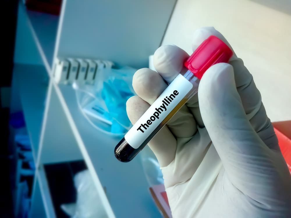 Veterinarian testing Theophylline levels in blood