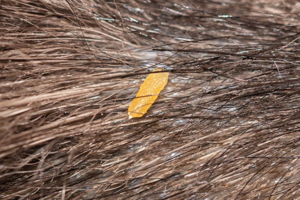 Tapeworm segment in pet's haircoat