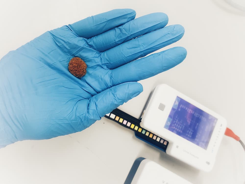 Vet holding urinary stone