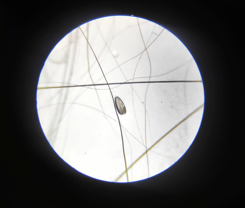 Microscopic view of a flea egg shape